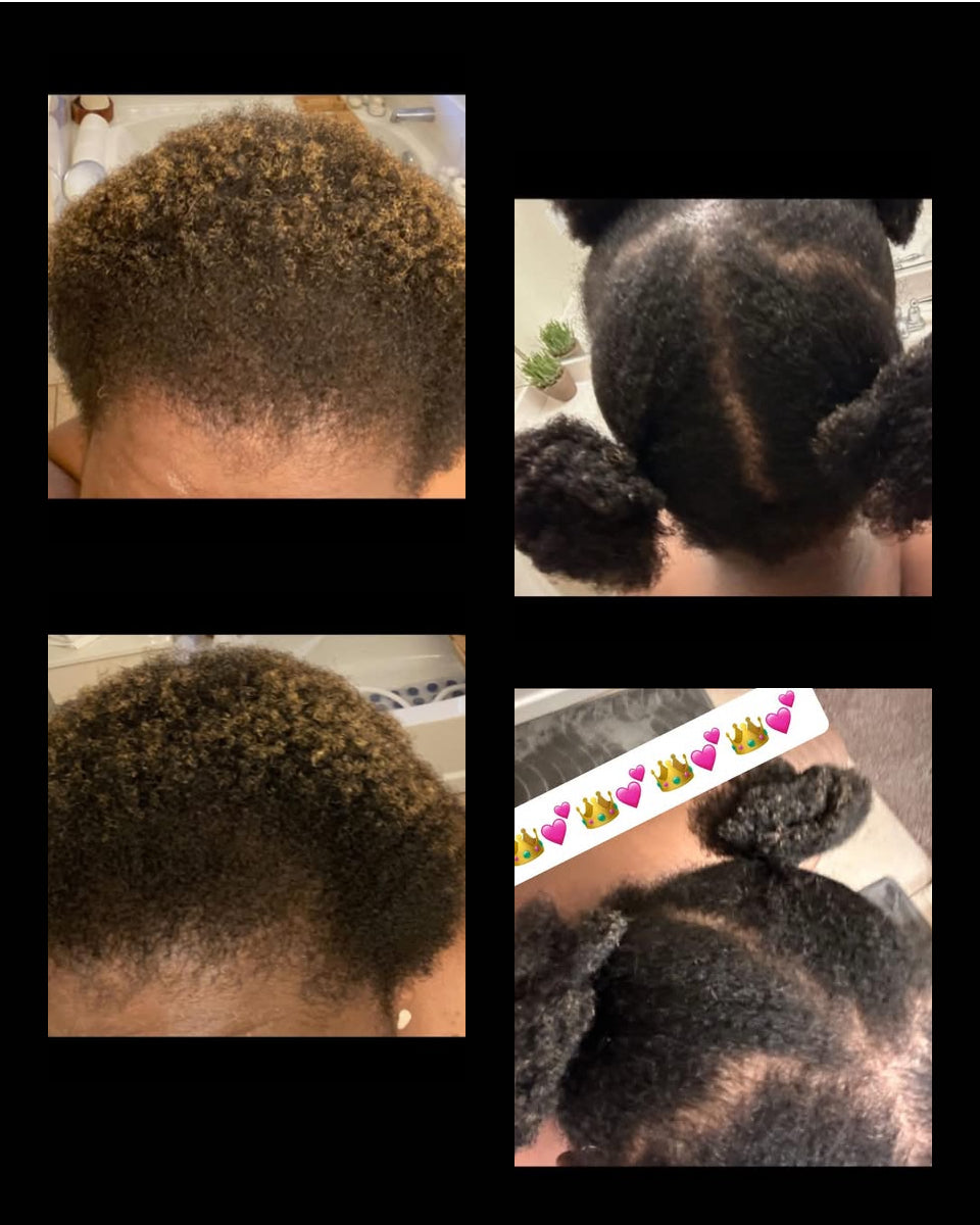 Crowned Drip Hair Growth Oil 4oz